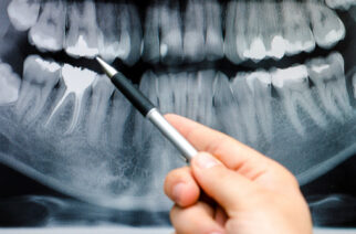 Dentist showing something on dental x-ray image on computer monitor.